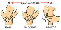サルコペニアの検査